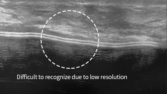 General Ultrasound device