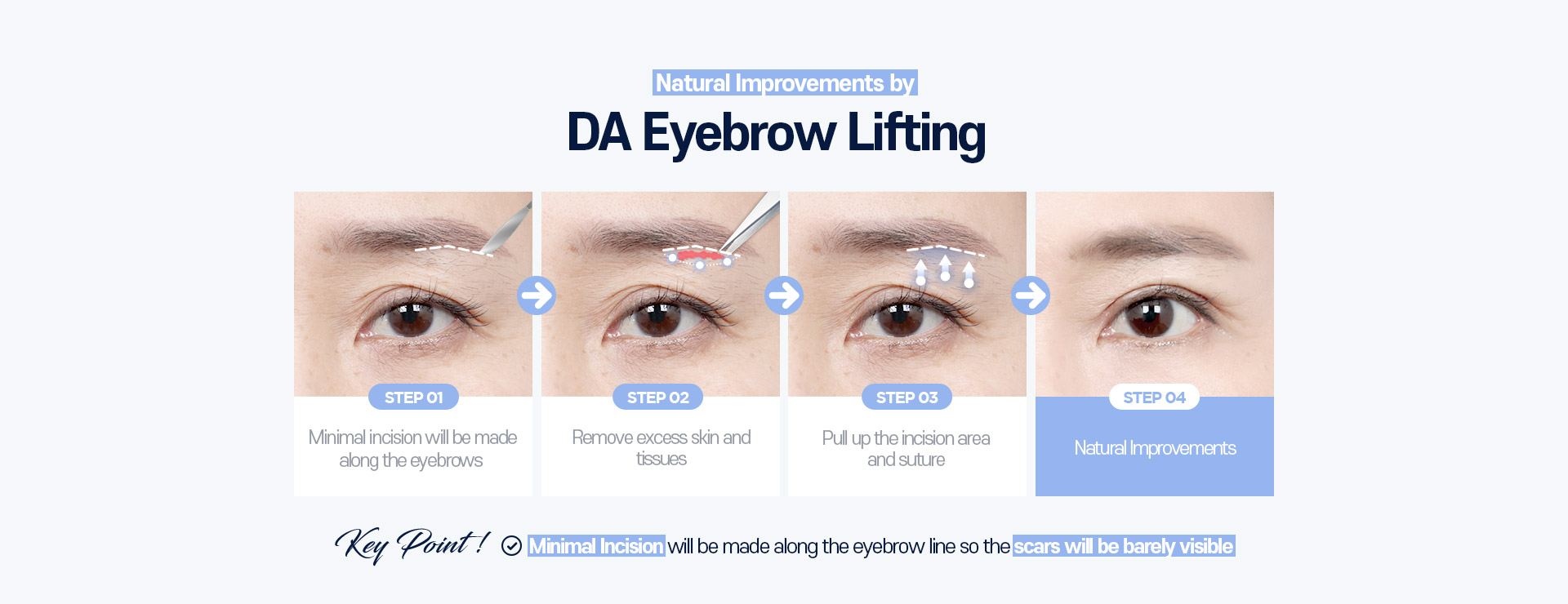 DAEyebrow Lifting