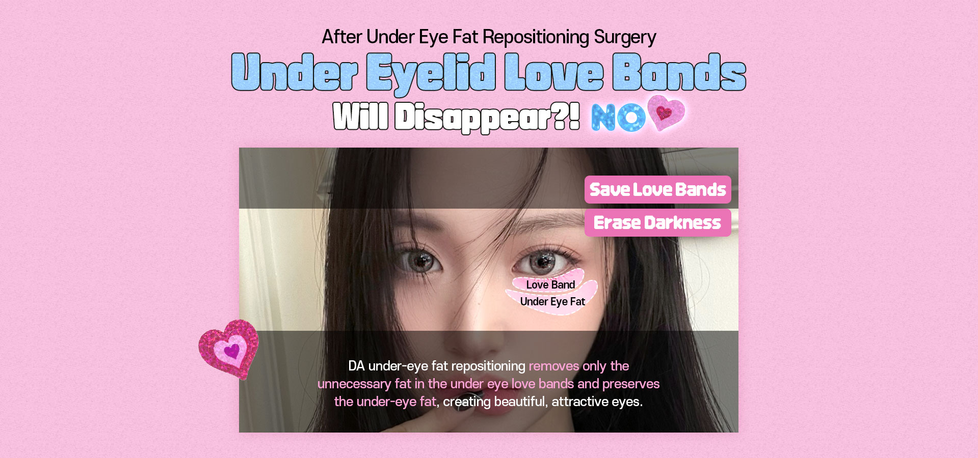 DA Under Eye Fat Repositioning