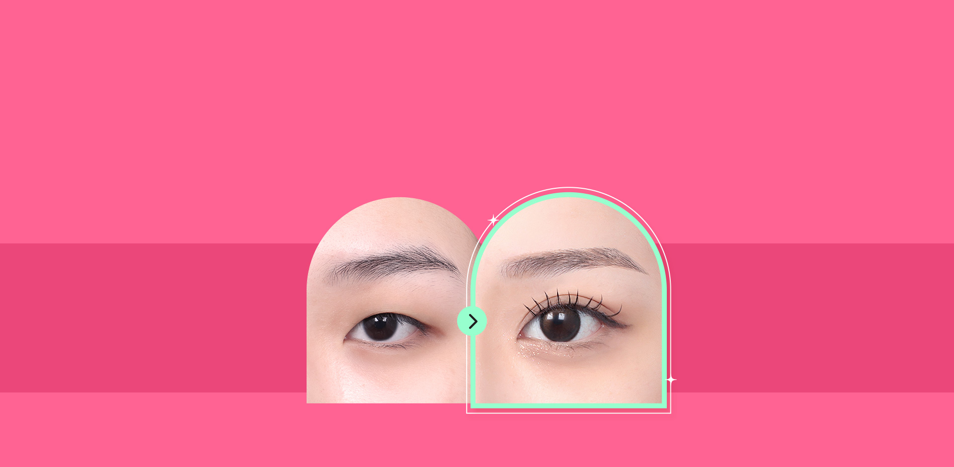 DA Blepharoplasty