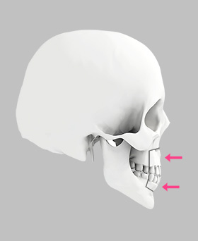 Mouth protrusion correction