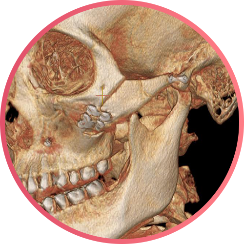 CT of DA actual patient