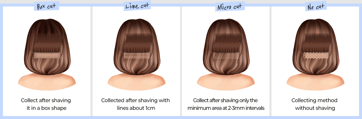 Non-incision (Occipital) Hair Cutting Method