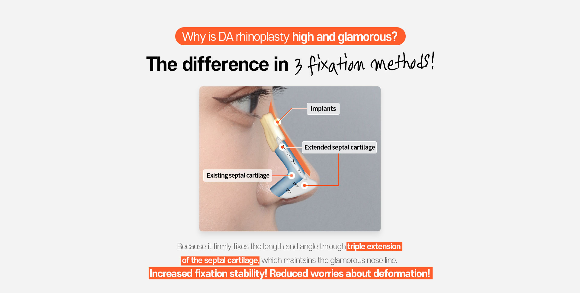 Autologous Cartilage Rhinoplasty