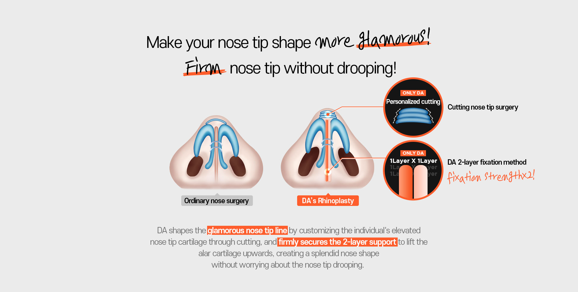 Autologous Cartilage Rhinoplasty