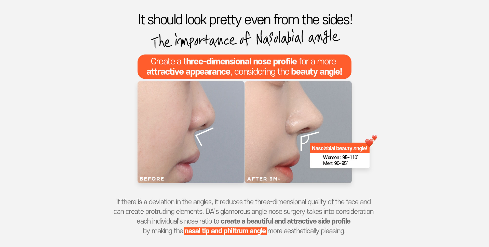 Autologous Cartilage Rhinoplasty