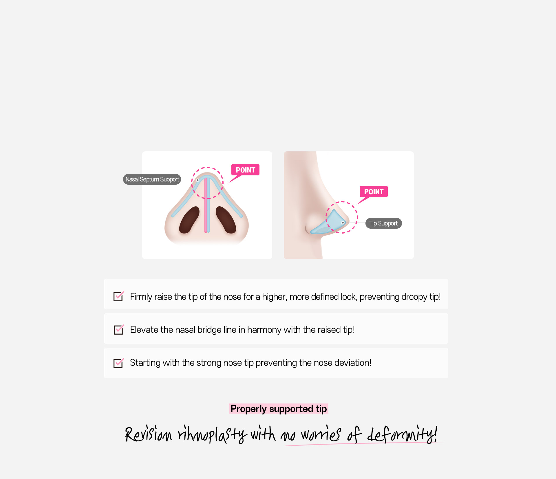 DA Revision Rhinoplasty