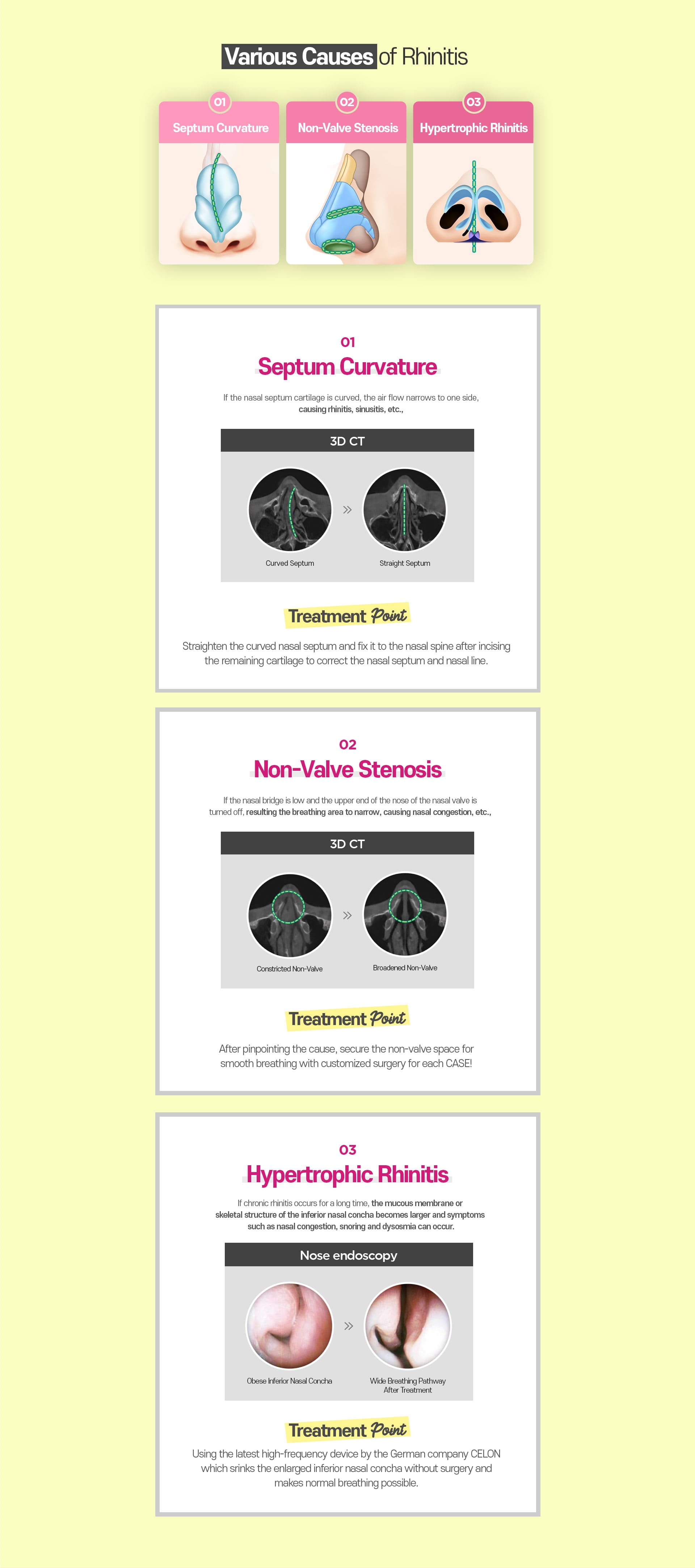 Various Causes of Rhinitis