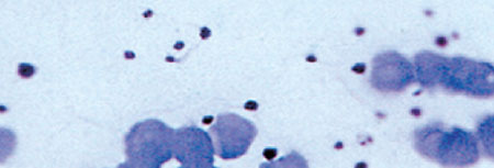 Conventional Stem Cell Image