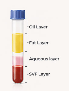 SVF Extraction